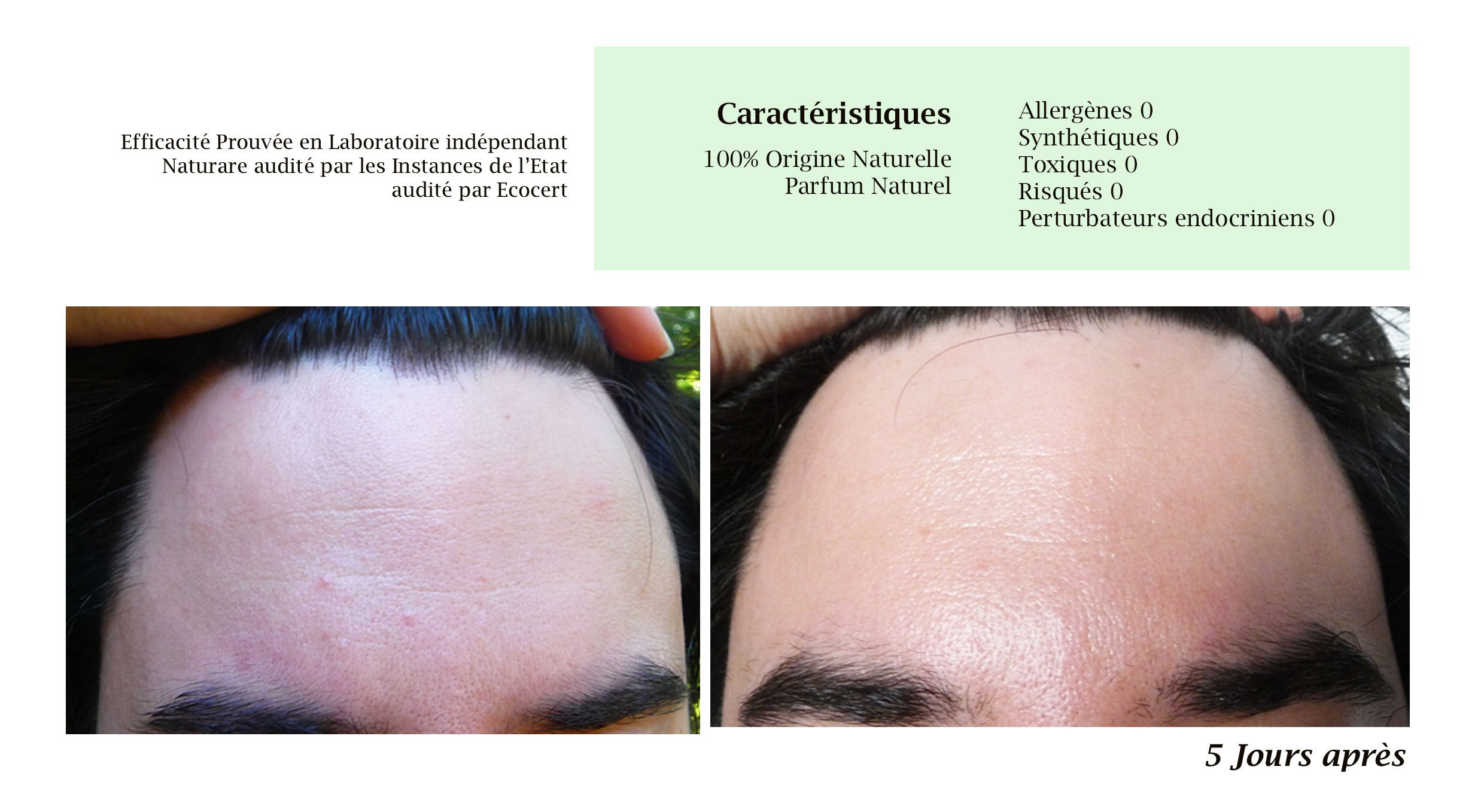 MERVEILLE DES LANDES ORGANIC - Sensitive Skin Care Complete Regeneration Face-12